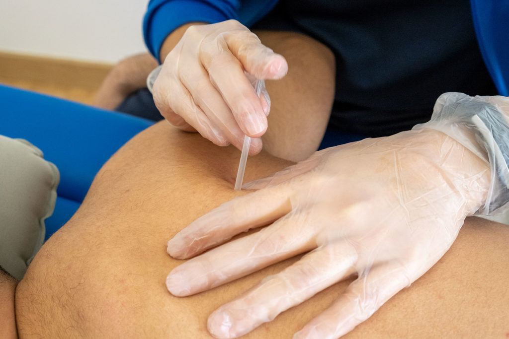 fisiosystem-centro-fisioterapia-palma-04